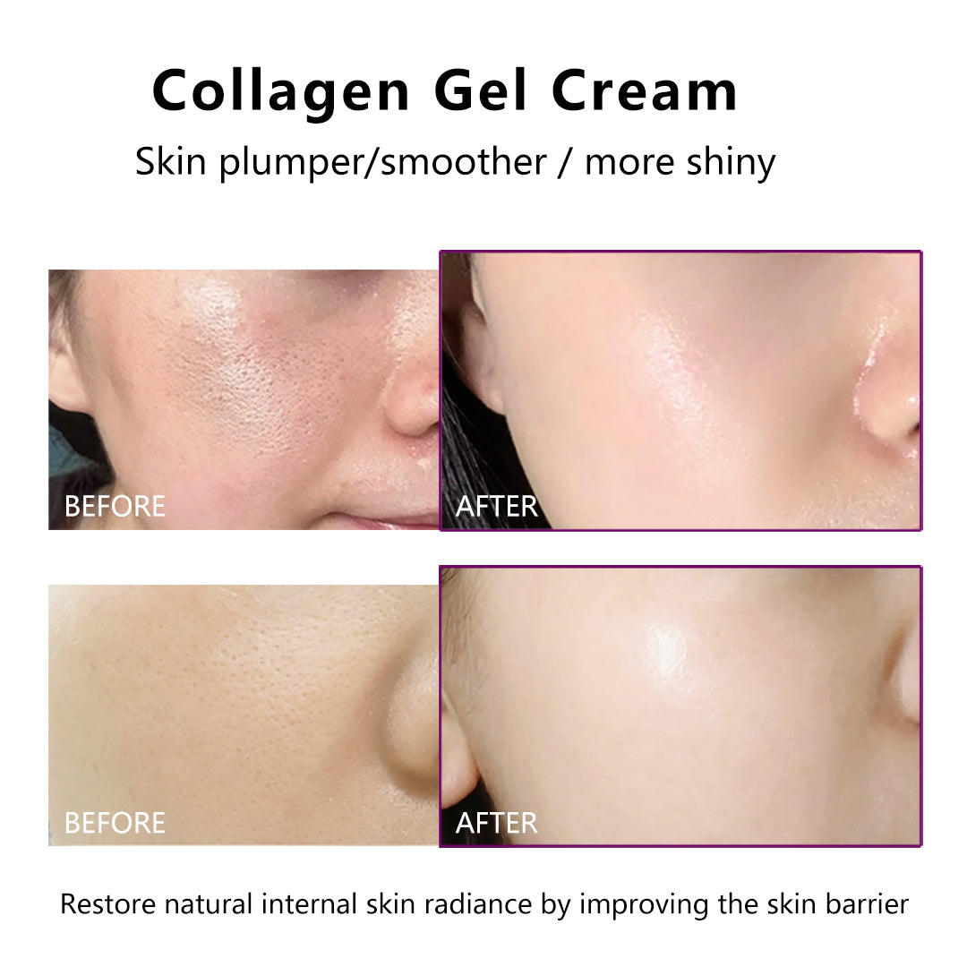SENNEY™ Platinum Luxury Collagen Gel Cream – Hydrate, Restore & Glow
